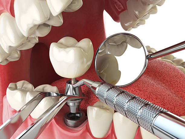 Best Emergency Treatment for Jaw Pain or Injury in , WA