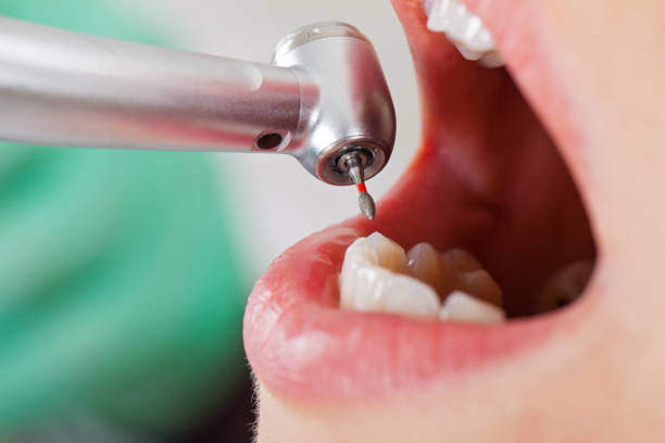 Best Emergency Treatment for Oral Infections in , WA